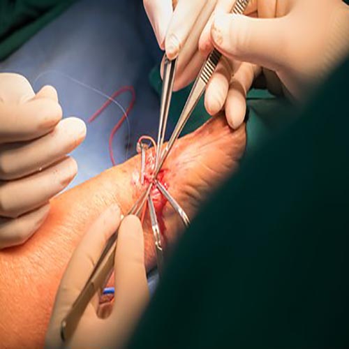 Vascular Surgeries near me